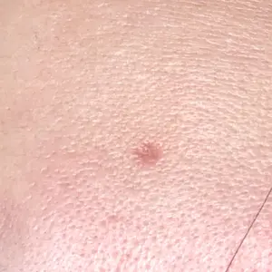 Fellez Clinic【フェルズクリニック】口コミ