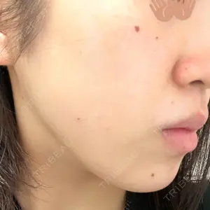 トラスト美容クリニック トラスト美容クリニック 銀座院口コミ