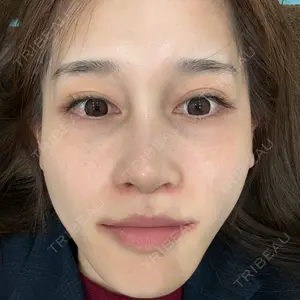 銀座マイアミ美容外科口コミ