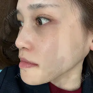 銀座マイアミ美容外科口コミ