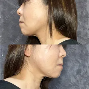 アリエル美容クリニック アリエル美容クリニック 水戸院口コミ