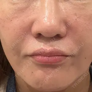 ルラ美容クリニック ルラ美容クリニック 宇都宮院口コミ