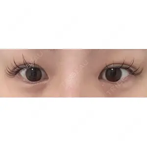 口コミ