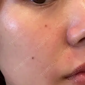 やさしい美容皮膚科・皮フ科 やさしい美容皮膚科・皮フ科　秋葉原院口コミ