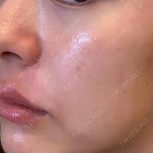 やさしい美容皮膚科・皮フ科 やさしい美容皮膚科・皮フ科　秋葉原院口コミ