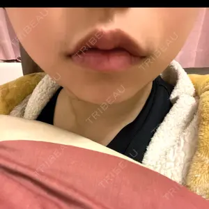 東京美容皮膚科アロエクリニック 東京美容皮膚科アロエクリニック池袋口コミ