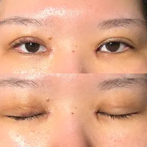 東京シンデレラ美容外科 東京シンデレラ美容外科 池袋院口コミ