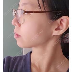 BITO BEAUTY CLINIC BITO BEAUTY CLINIC口コミ