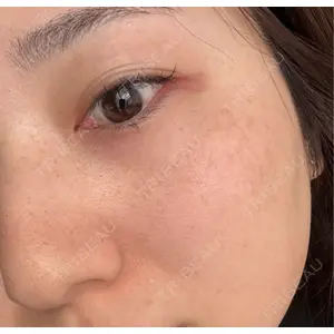 L‘amour clinic Tokyo【ラムールクリニック東京】口コミ