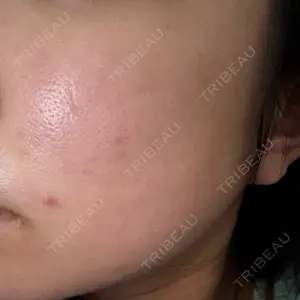 やさしい美容皮膚科・皮フ科 やさしい美容皮膚科・皮フ科　秋葉原院口コミ