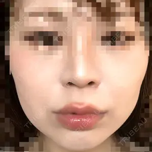 表参道スキンクリニック 表参道スキンクリニック 大阪院口コミ