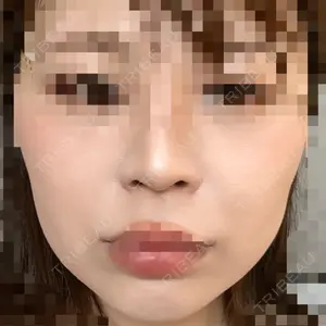 表参道スキンクリニック 表参道スキンクリニック 大阪院口コミ