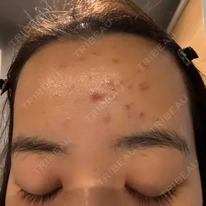 日本美容・医療クリニック 日本美容・医療クリニック 六本木院口コミ