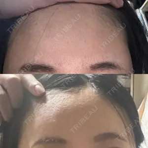 PRISM Beauty Clinic  PRISM Beauty Clinic 新宿院口コミ