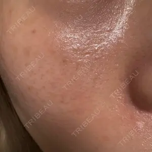 ビラビューティークリニック 博多美容外科/美容皮膚科 ビラビューティークリニック口コミ