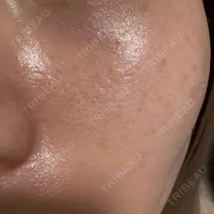 ビラビューティークリニック 博多美容外科/美容皮膚科 ビラビューティークリニック口コミ