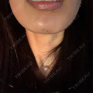 ビラビューティークリニック 博多美容外科/美容皮膚科 ビラビューティークリニック口コミ