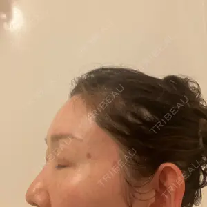 東京シルククリニック 東京シルククリニック 新宿院口コミ