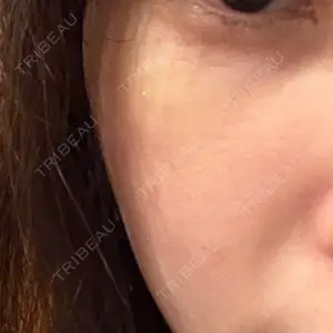 アイネクリニック アイネクリニック　川崎院口コミ