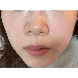 トラスト美容クリニック トラスト美容クリニック 銀座院口コミ
