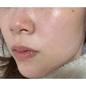 トラスト美容クリニック トラスト美容クリニック 銀座院口コミ