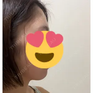 東京脂肪吸引クリニック口コミ