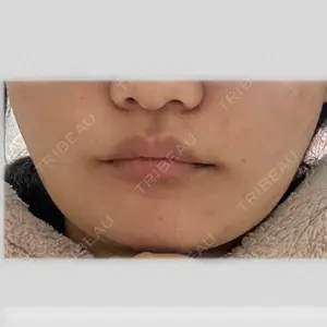 Nebula Clinic 新宿美容外科ネビュラクリニック口コミ