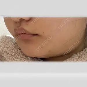 Nebula Clinic 新宿美容外科ネビュラクリニック口コミ