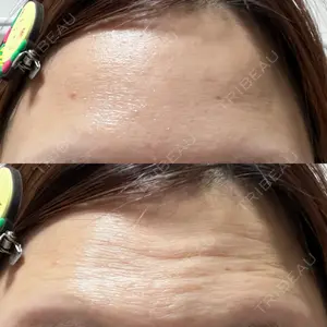 ビラビューティークリニック 博多美容外科/美容皮膚科 ビラビューティークリニック口コミ