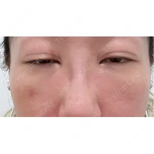 PRISM Beauty Clinic  PRISM Beauty Clinic 新宿院口コミ