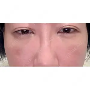 PRISM Beauty Clinic  PRISM Beauty Clinic 新宿院口コミ