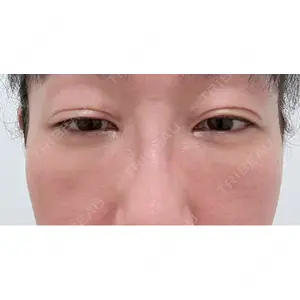 PRISM Beauty Clinic  PRISM Beauty Clinic 新宿院口コミ