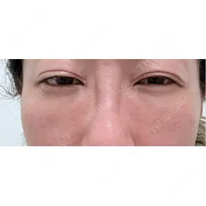 PRISM Beauty Clinic  PRISM Beauty Clinic 新宿院口コミ