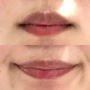 ビラビューティークリニック 博多美容外科/美容皮膚科 ビラビューティークリニック口コミ