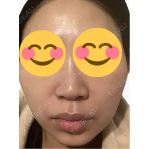 南青山コスメクリニック口コミ