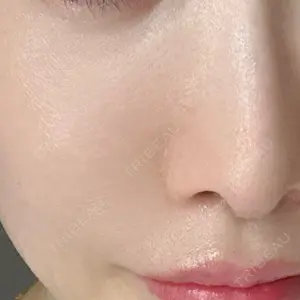 HAAB CLINIC HAAB×DREAM BEAUTY CLINIC 東京本院口コミ