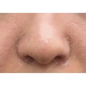 GLANZ CLINIC口コミ