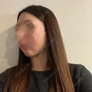 アリエル美容クリニック アリエル美容クリニック 水戸院口コミ