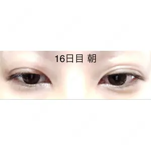口コミ