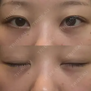 湘南美容クリニック 湘南美容クリニック 千葉センシティ院口コミ