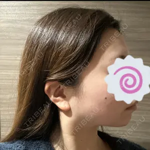 L‘amour clinic Tokyo【ラムールクリニック東京】口コミ