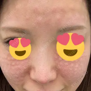 NARU Beauty Clinic NARU Beauty Clinic 【ナルクリ】 水戸院口コミ