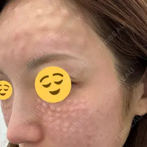 NARU Beauty Clinic NARU Beauty Clinic 【ナルクリ】 水戸院口コミ