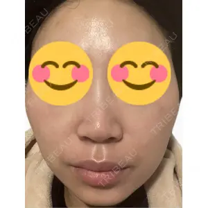 南青山コスメクリニック口コミ