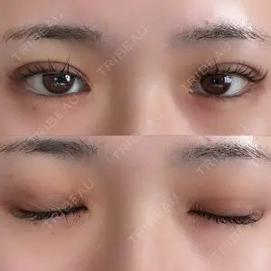 アリエル美容クリニック アリエル美容クリニック 水戸院口コミ