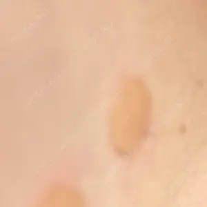 Fellez Clinic【フェルズクリニック】口コミ