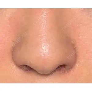 GLANZ CLINIC口コミ