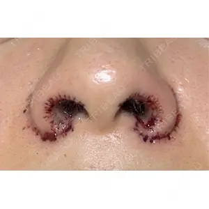 GLANZ CLINIC口コミ