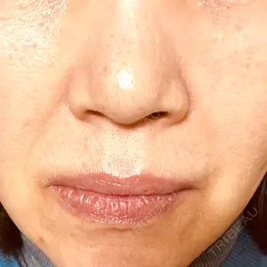 ON-CLINIC Beauty口コミ