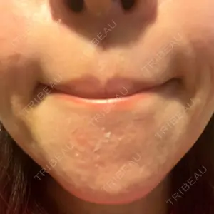 南青山コスメクリニック口コミ